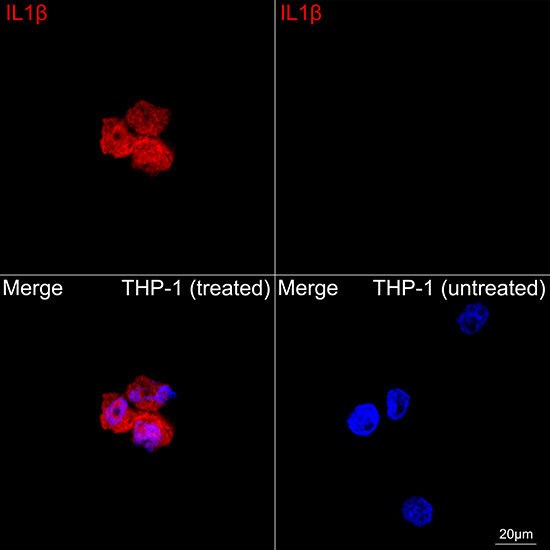 IL-1 beta Antibody in Immunocytochemistry (ICC/IF)