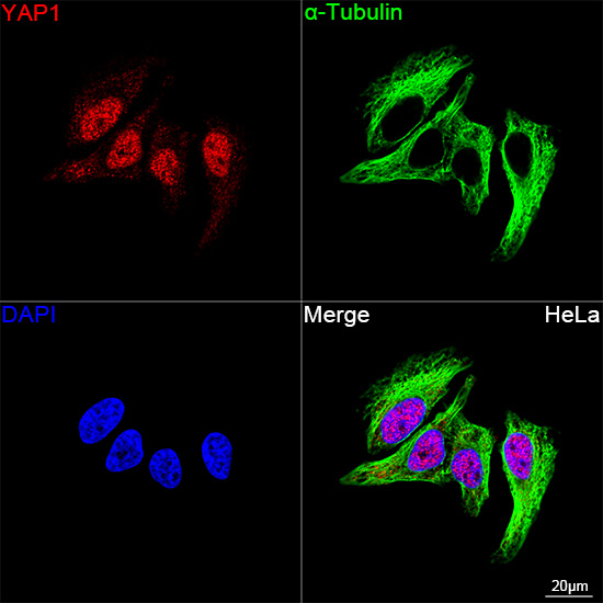 YAP1 Antibody in Immunocytochemistry (ICC/IF)