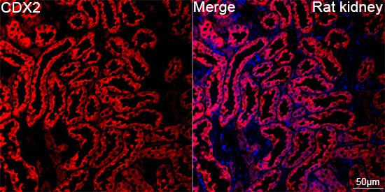 CHDH Antibody in Immunohistochemistry (Paraffin) (IHC (P))