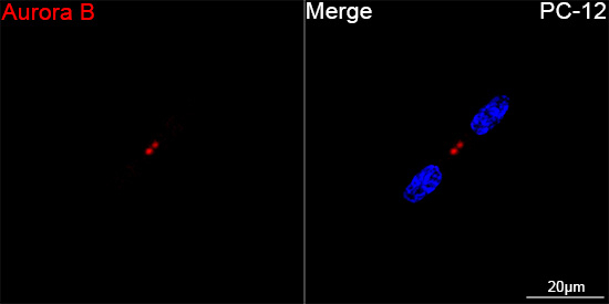 Aurora B Antibody in Immunocytochemistry (ICC/IF)