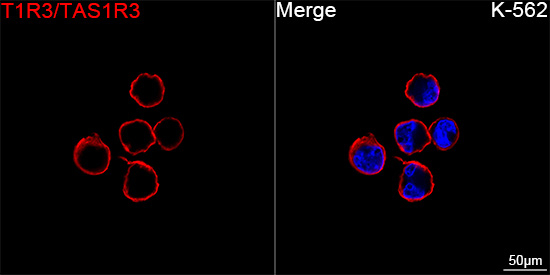 TAS1R3 Antibody in Immunocytochemistry (ICC/IF)