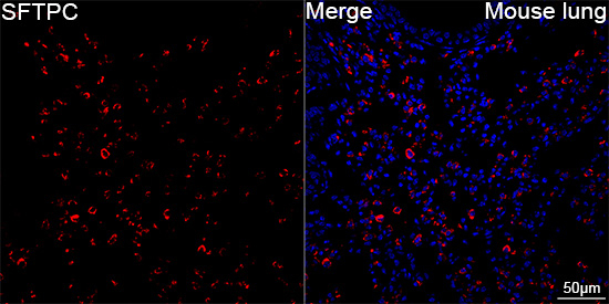 SFTPC Antibody in Immunohistochemistry (Paraffin) (IHC (P))