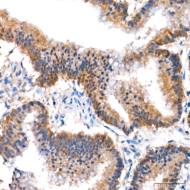 AMPK alpha-1,2 Antibody in Immunohistochemistry (Paraffin) (IHC (P))