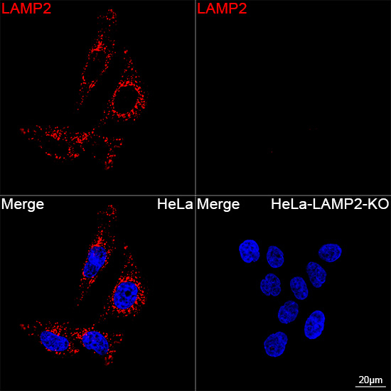 LAMP2 Antibody in Immunocytochemistry (ICC/IF)