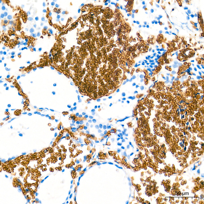 EPB41 Antibody in Immunohistochemistry (Paraffin) (IHC (P))