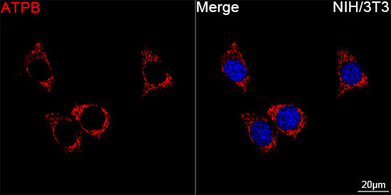 ATP Synthase beta Antibody in Immunocytochemistry (ICC/IF)