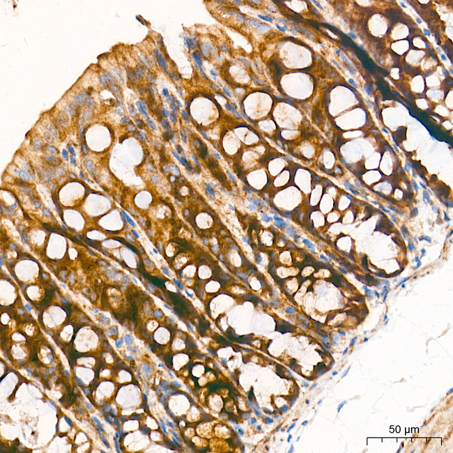 MBTPS1 Antibody in Immunohistochemistry (Paraffin) (IHC (P))