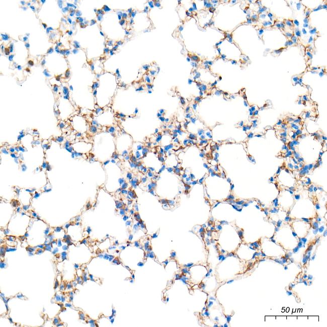 CHI3L1 Antibody in Immunohistochemistry (Paraffin) (IHC (P))