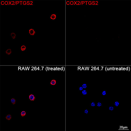 COX2 Antibody in Immunocytochemistry (ICC/IF)