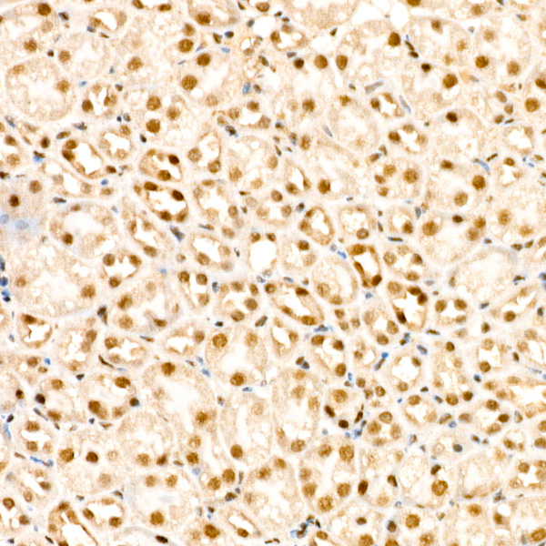 Phospho-PP1 alpha (Thr320) Antibody in Immunohistochemistry (Paraffin) (IHC (P))