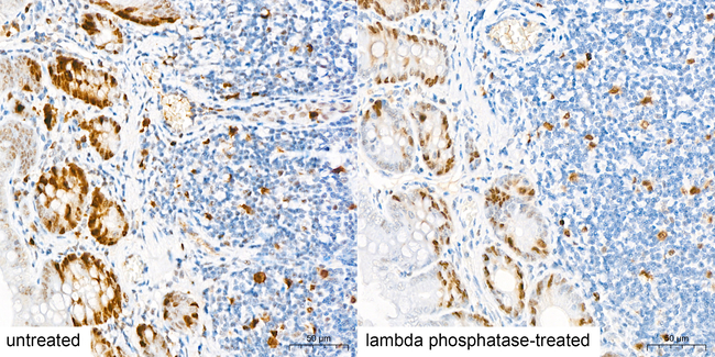 Phospho-CDK1/CDK2/CDK3 (Thr161, Thr160) Antibody in Immunohistochemistry (Paraffin) (IHC (P))
