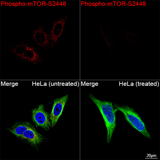Phospho-mTOR (Ser2448) Antibody in Immunocytochemistry (ICC/IF)