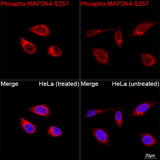 Phospho-MAP2K4 (Ser257) Antibody in Immunocytochemistry (ICC/IF)
