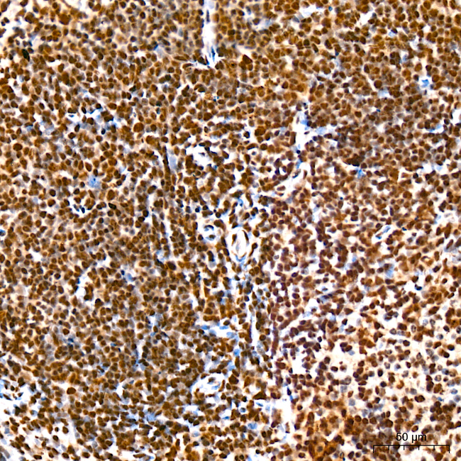 Phospho-RPA32 (Ser33) Antibody in Immunohistochemistry (Paraffin) (IHC (P))