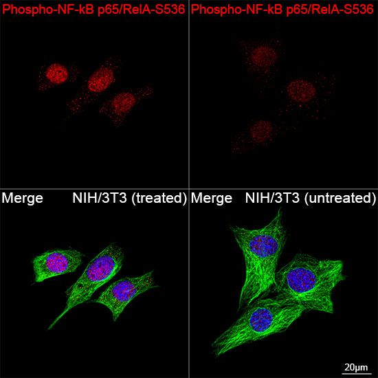 Phospho-NFkB p65 (Ser536) Antibody in Immunocytochemistry (ICC/IF)