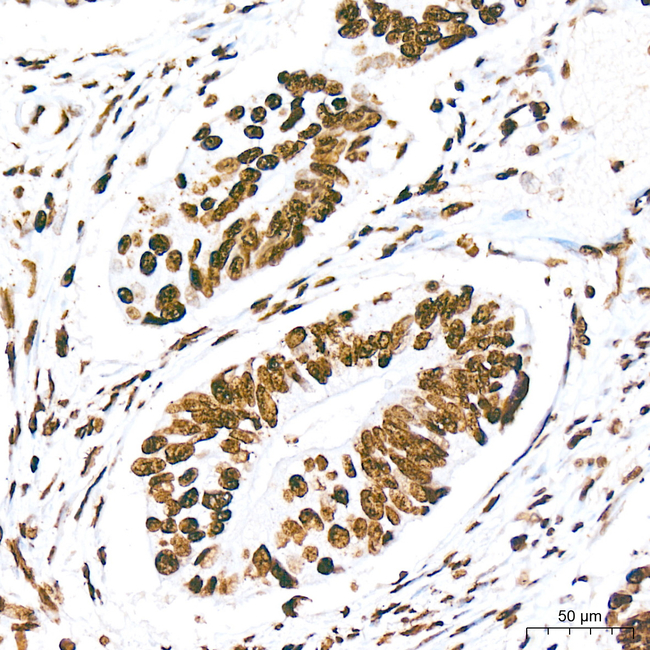 Phospho-TIFA (Thr9) Antibody in Immunohistochemistry (Paraffin) (IHC (P))