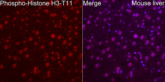 Phospho-Histone H3 (Thr11) Antibody in Immunohistochemistry (Paraffin) (IHC (P))