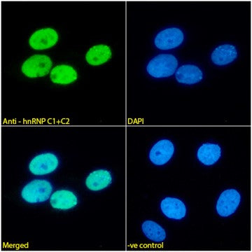 hnRNP C1/C2 Antibody in Immunocytochemistry (ICC/IF)