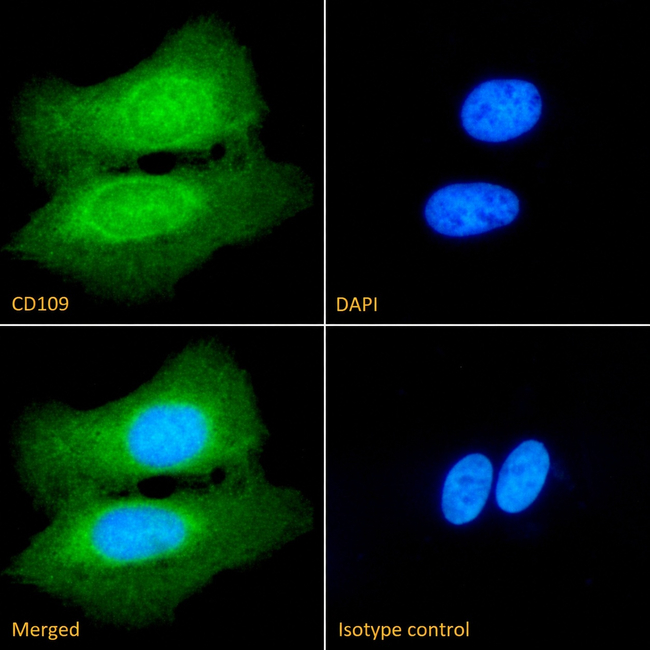 CD109 Antibody in Immunocytochemistry (ICC/IF)