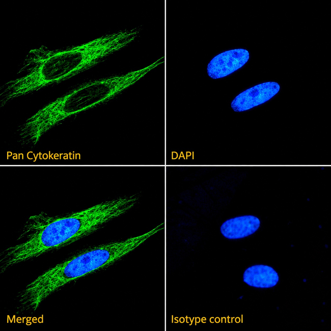Pan Cytokeratin Antibody in Immunocytochemistry (ICC/IF)