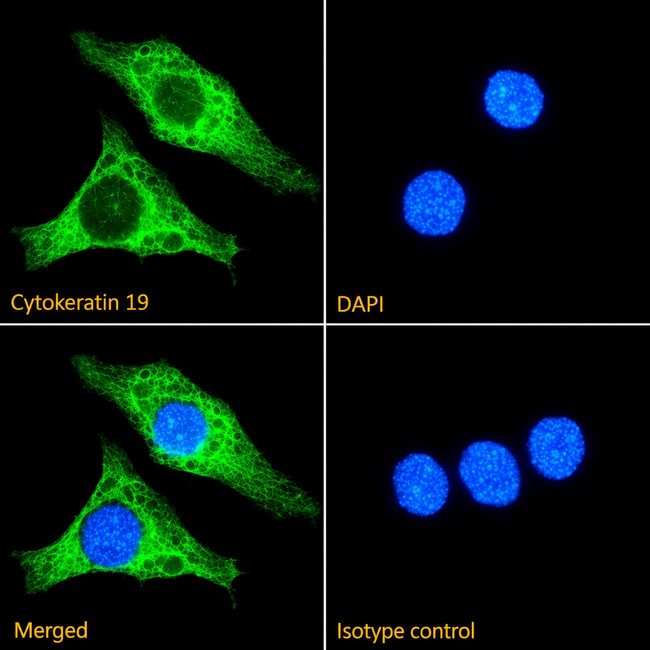 Cytokeratin 19 Antibody in Immunocytochemistry (ICC/IF)