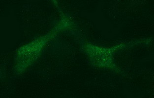 MADCAM1 Antibody in Immunocytochemistry (ICC/IF)