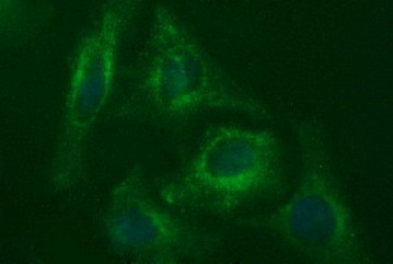 MADCAM1 Antibody in Immunocytochemistry (ICC/IF)