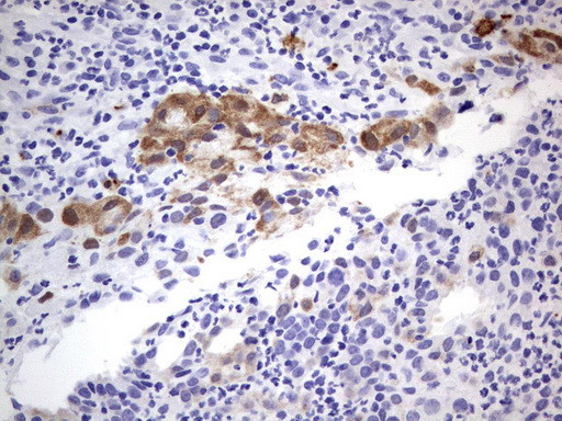 MADCAM1 Antibody in Immunohistochemistry (Paraffin) (IHC (P))
