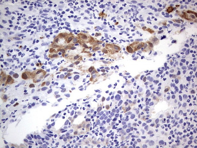 MADCAM1 Antibody in Immunohistochemistry (Paraffin) (IHC (P))