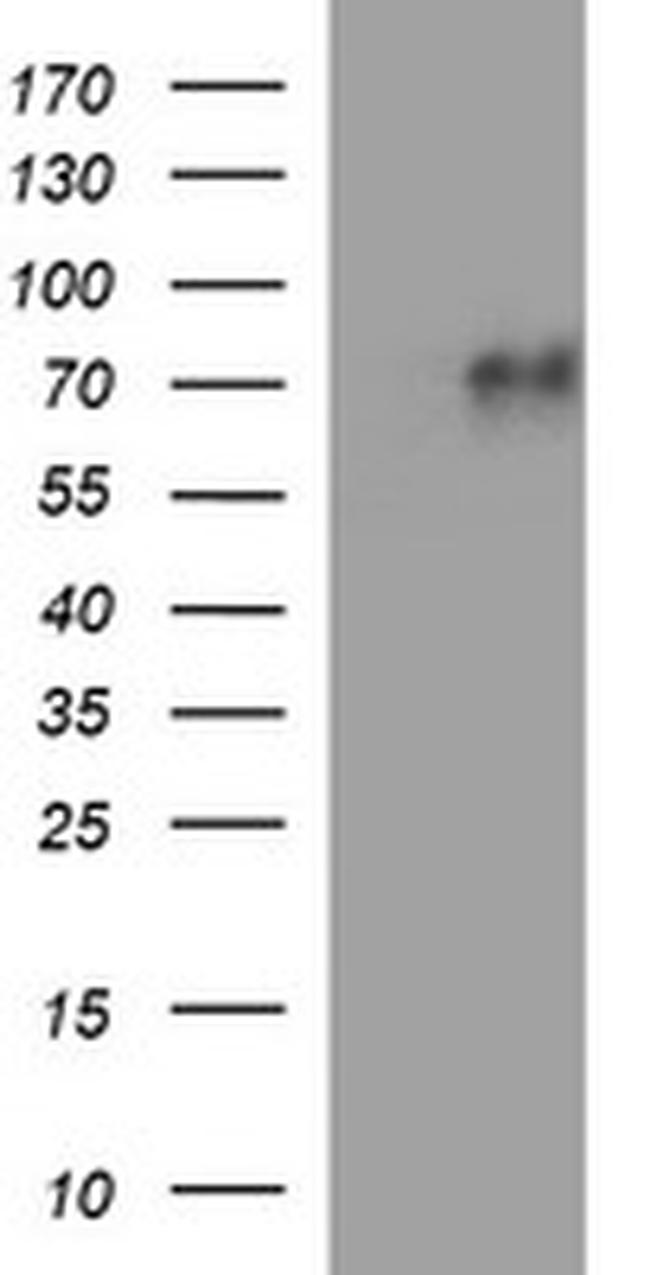 MADCAM1 Antibody in Western Blot (WB)