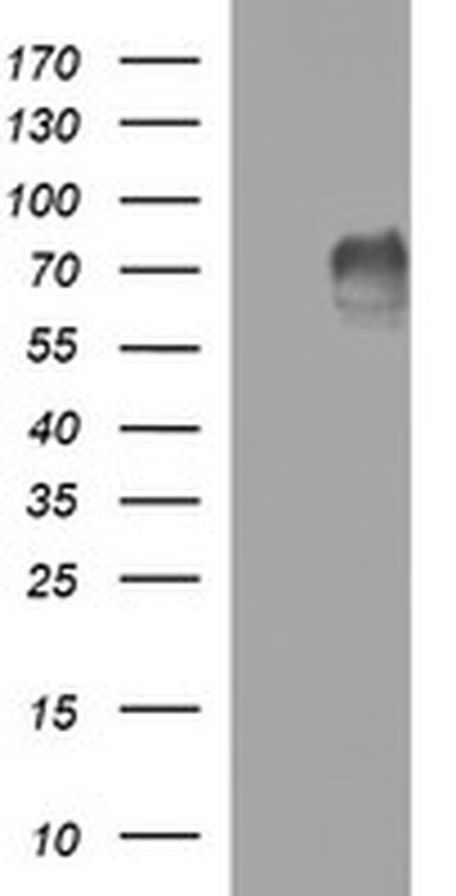 MADCAM1 Antibody in Western Blot (WB)