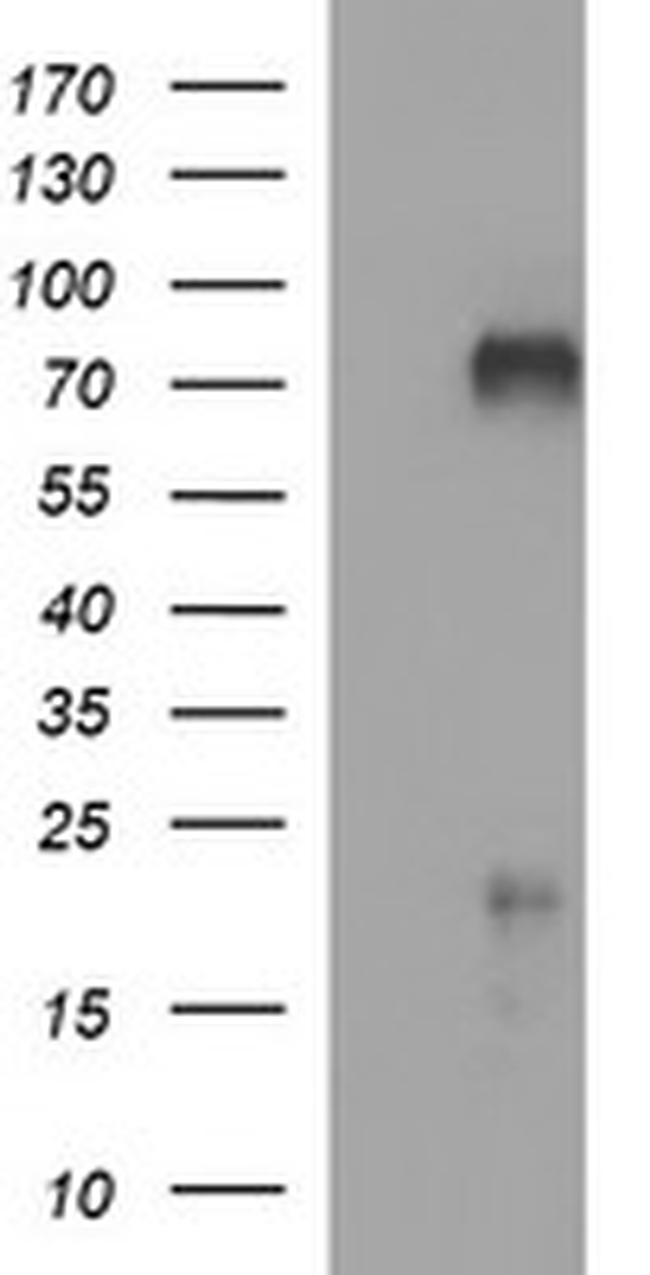 MADCAM1 Antibody in Western Blot (WB)