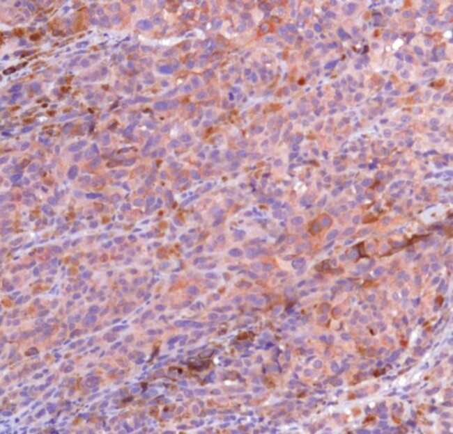 MAGE1 Antibody in Immunohistochemistry (IHC)