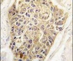 MAGE1 Antibody in Immunohistochemistry (IHC)