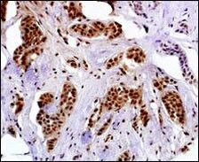 MAGEA4 Antibody in Immunohistochemistry (IHC)