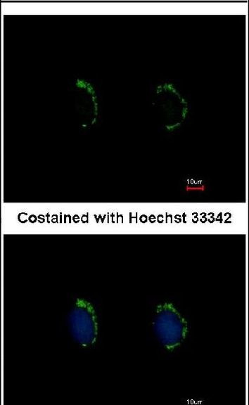 MAGEA8 Antibody in Immunocytochemistry (ICC/IF)
