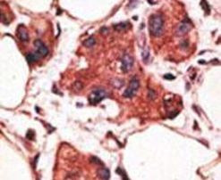 MAGEA9 Antibody in Immunohistochemistry (IHC)