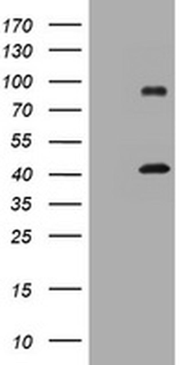MAGEA9 Antibody in Western Blot (WB)