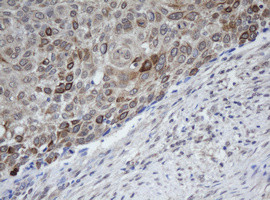 MAGEB1 Antibody in Immunohistochemistry (Paraffin) (IHC (P))