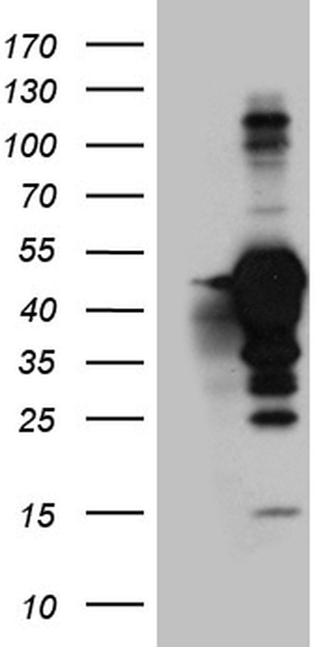 MAGEB4 Antibody in Western Blot (WB)