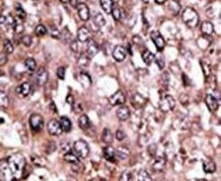 MAGEC1 Antibody in Immunohistochemistry (IHC)