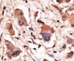 MAGED1 Antibody in Immunohistochemistry (IHC)