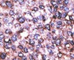 MAGED2 Antibody in Immunohistochemistry (IHC)