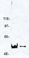 MAGI3 Antibody in Western Blot (WB)