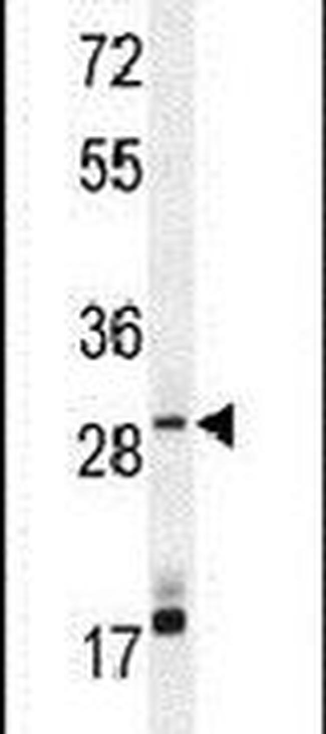 MAGIX Antibody in Western Blot (WB)