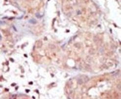MAK Antibody in Immunohistochemistry (IHC)
