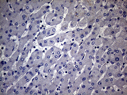 MAK Antibody in Immunohistochemistry (Paraffin) (IHC (P))