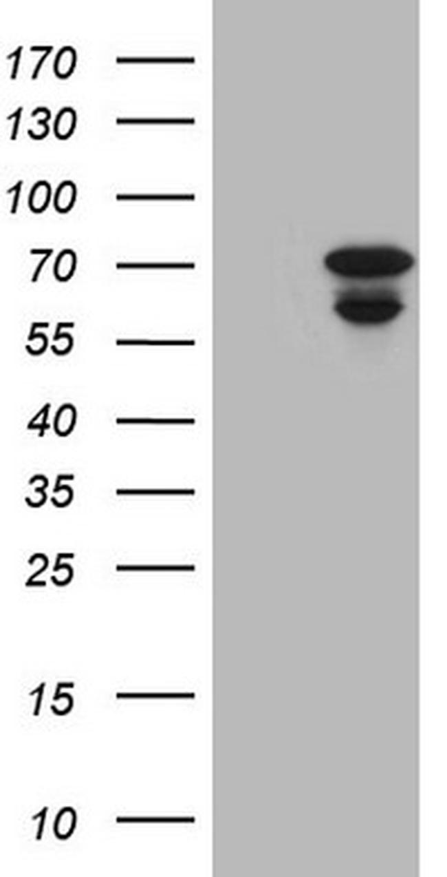 MAK Antibody in Western Blot (WB)