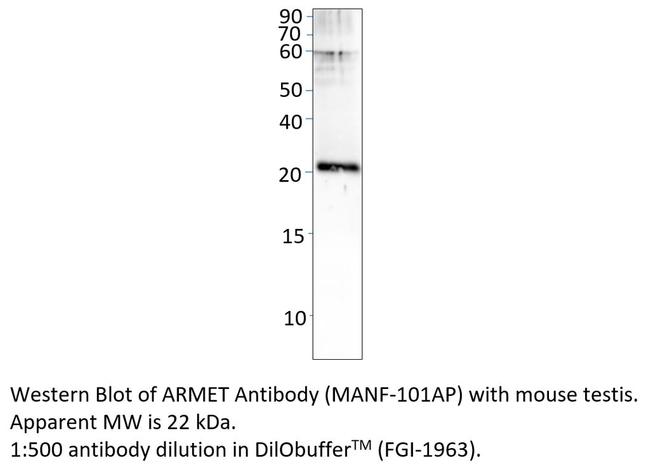 ARMET Antibody in Western Blot (WB)