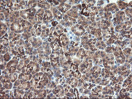 MAOA Antibody in Immunohistochemistry (Paraffin) (IHC (P))